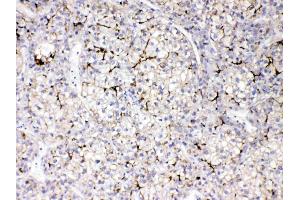 Immunohistochemistry (IHC) image for anti-Apolipoprotein B (APOB) (AA 246-450) antibody (ABIN4886467)