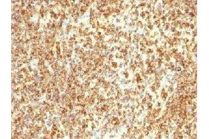 Immunohistochemistry (IHC) image for anti-Membrane-Spanning 4-Domains, Subfamily A, Member 1 (MS4A1) antibody (ABIN3026620)