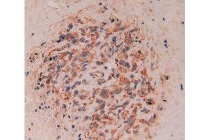 Used in DAB staining on fromalin fixed paraffin- embedded lung cancer tissue (CD8B 抗体  (AA 22-170))
