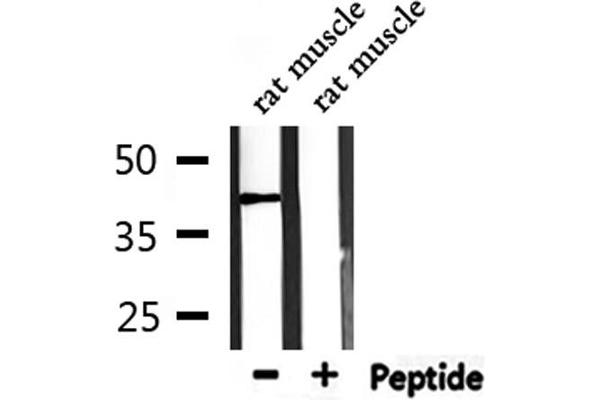 Angiotensin II Type-1 Receptor 抗体  (N-Term)