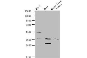 Western blot All lanes: MRGPRX2 antibody at 5 μg/mL Lane 1: 293T whole cell lysate Lane 2: Mouse liver tissue Secondary Goat polyclonal to rabbit IgG at 1/10000 dilution Predicted band size: 38 kDa Observed band size: 38 kDa (MRGPRX2 抗体  (AA 286-330))