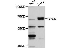 Western blot analysis of extracts of various cell lines, using GPC6 antibody (ABIN5974717) at 1/1000 dilution. (Glypican 6 抗体)
