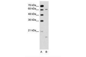 Image no. 2 for anti-Cytochrome P450, Family 4, Subfamily A, Polypeptide 22 (CYP4A22) (N-Term) antibody (ABIN6736345) (CYP4A22 抗体  (N-Term))