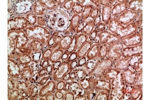 Immunohistochemical analysis of paraffin-embedded human-kidney, antibody was diluted at 1:200 (c-Rel 抗体  (AA 491-540))
