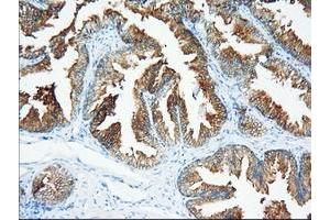 Immunohistochemical staining of paraffin-embedded Human prostate tissue using anti-XPNPEP1 mouse monoclonal antibody. (XPNPEP1 抗体)