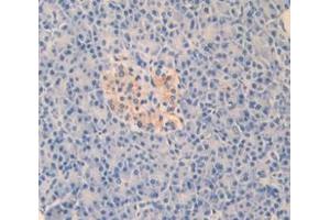IHC-P analysis of Human Tissue, with DAB staining. (LEFTY1 抗体  (AA 78-361))