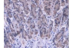DAB staining on IHC-P; Samples: Rat Stomach Tissue (MRPL1 抗体  (AA 141-323))