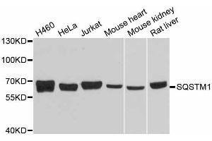 Western blot analysis of extracts of various cell lines, using SQSTM1 antibody. (SQSTM1 抗体  (AA 1-440))