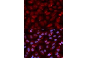 Immunofluorescence analysis of U2OS cell using CD47 antibody. (CD47 抗体)