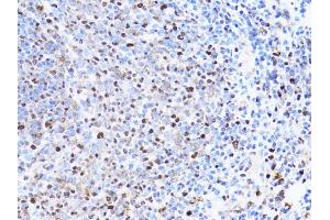 Immunohistochemistry of paraffin-embedded rat spleen using PCNA antibody (ABIN1874056) at dilution of 1:100 (40x lens). (PCNA 抗体)