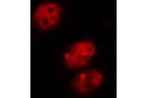 ABIN6267585 staining COS7 by IF/ICC. (MDM2 抗体  (pSer166))