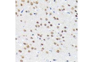 Immunohistochemistry of paraffin-embedded rat brain using Cullin 3 antibody (ABIN7266543) at dilution of 1:100 (40x lens). (Cullin 3 抗体)