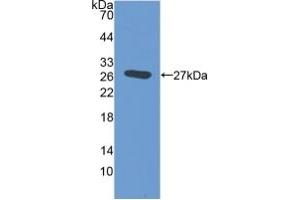 Detection of Recombinant EMILIN2, Mouse using Polyclonal Antibody to Elastin Microfibril Interface Located Protein 2 (EMILIN2) (EMILIN2 抗体  (AA 853-1074))