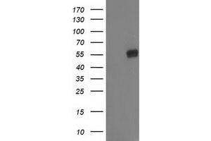 Western Blotting (WB) image for anti-Glucosidase, Beta, Acid 3 (Cytosolic) (GBA3) (AA 1-150), (AA 370-469) antibody (ABIN1490586) (GBA3 抗体  (AA 1-150, AA 370-469))
