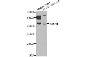 Western blot analysis of extracts of various cell lines, using VASH1 antibody (ABIN6290544) at 1:1000 dilution. (VASH1 抗体)