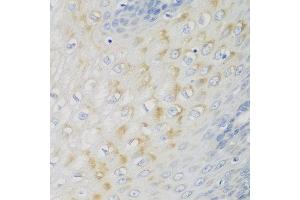 Immunohistochemistry of paraffin-embedded human esophagus using NME4 antibody at dilution of 1:100 (40x lens). (NME4 抗体)