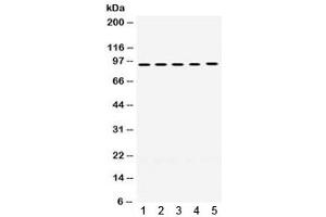 Western blot testing of human 1) A549, 2) SW620, 3) HeLa, 4) PANC, and 5) HepG2 lysate with MCM8 antibody.