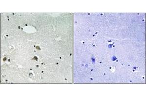 Immunohistochemistry analysis of paraffin-embedded human brain tissue, using S6 Ribosomal Protein (Ab-235/236) Antibody. (RPS6 抗体  (AA 200-249))