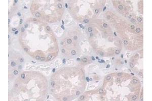 Immunohistochemistry (IHC) image for anti-Plasminogen Activator Inhibitor 1 (SERPINE1) antibody (ABIN7427915)