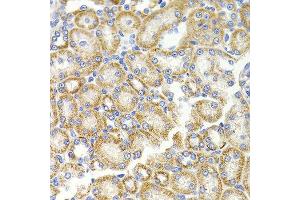 Immunohistochemistry of paraffin-embedded rat kidney using BMP15 antibody at dilution of 1:100 (x40 lens). (BMP15 抗体)