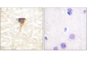 Immunohistochemistry analysis of paraffin-embedded human brain tissue, using CaMK4 (Ab-196/200) Antibody. (CAMK4 抗体  (AA 166-215))