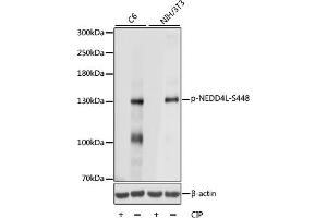 Western blot analysis of extracts of various cell lines, using Phospho-NEDD4L-S448 antibody (ABIN7266883) at 1:1000 dilution. (NEDD4-2 抗体  (pSer448))