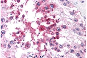 Human Testis: Formalin-Fixed, Paraffin-Embedded (FFPE) (DNAL1 抗体  (C-Term))