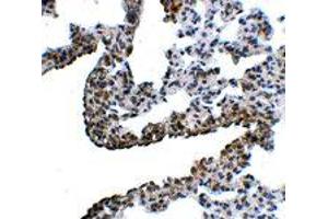Immunohistochemistry of PCDH12 in rat lung tissue with PCDH12 polyclonal antibody  at 5 ug/mL . (PCDH12 抗体  (N-Term))