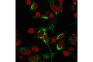 Immunofluorescence Analysis of PFA-fixed HepG2 cells labeling AFP using AFP Mouse Monoclonal Antibody (C2 + C3 + MBS-12) followed by Goat anti-Mouse IgG-CF488 (Green). (alpha Fetoprotein 抗体)