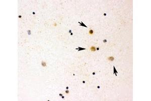 Immunocytochemistry (ICC) image for anti-Interleukin 16 (IL16) (AA 1212-1332) antibody (ABIN3031455)