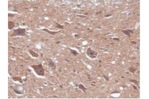 Figure. (CAMK2A 抗体  (AA 1-478))