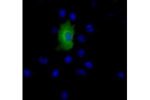 Anti-EPHX2 mouse monoclonal antibody (ABIN2452988) immunofluorescent staining of COS7 cells transiently transfected by pCMV6-ENTRY EPHX2 (RC202489). (EPHX2 抗体)