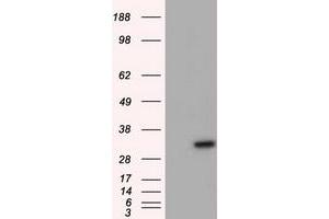 Western Blotting (WB) image for anti-Nitrilase Family, Member 2 (NIT2) antibody (ABIN1499740)