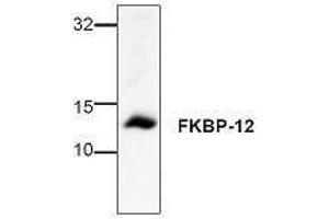 Image no. 1 for anti-FK506 Binding Protein 1A, 12kDa (FKBP1A) antibody (ABIN127265) (FKBP1A 抗体)