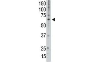Western Blotting (WB) image for anti-Melanoma Antigen Family D, 2 (MAGED2) antibody (ABIN3002534) (MAGED2 抗体)