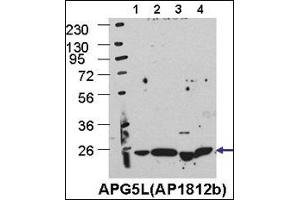 Cos7, HE, MEF, and Hela cells left to right, respectively. (ATG5 抗体  (C-Term))