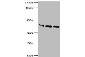 Western blot All lanes: Apolipoprotein L1 antibody at 10 μg/mL Lane 1: A549 whole cell lysate Lane 2: Hela whole cell lysate Lane 3: HepG2 whole cell lysate Secondary Goat polyclonal to rabbit IgG at 1/10000 dilution Predicted band size: 44, 46, 43 kDa Observed band size: 44 kDa (APOL1 抗体  (AA 179-398))
