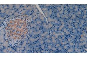 Detection of MMP3 in Rat Pancreas Tissue using Polyclonal Antibody to Matrix Metalloproteinase 3 (MMP3)