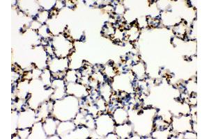 Anti- ITGA2B Picoband antibody, IHC(P) IHC(P): Mouse Lung Tissue (Integrin Alpha2b 抗体  (C-Term))