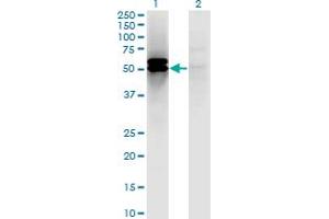 Western Blotting (WB) image for anti-Dihydrolipoamide S-Succinyltransferase (E2 Component of 2-Oxo-Glutarate Complex) (DLST) (AA 1-99) antibody (ABIN1774880)