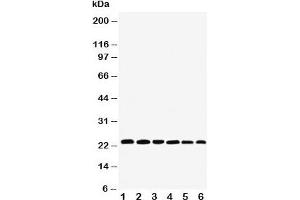 Western blot testing of SNAP23 antibody and Lane 1:  rat spleen;  2: (r) testis;  3: (r) ovary;  4: human HeLa;  5: (h) MCF-7;  6: (h) SKOV;  Expected size: ~23KD (SNAP23 抗体  (C-Term))