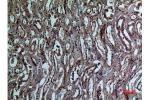 Immunohistochemistry (IHC) analysis of paraffin-embedded Human Kidney, antibody was diluted at 1:100. (BNIP3 抗体  (Internal Region))