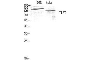 Western Blotting (WB) image for anti-Telomerase Reverse Transcriptase (TERT) (Tyr1510) antibody (ABIN3177676) (TERT 抗体  (Tyr1510))