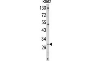 Western Blotting (WB) image for anti-CD40 Ligand (CD40LG) antibody (ABIN3002678) (CD40 Ligand 抗体)