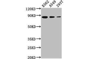 Western Blot Positive WB detected in: K562 whole cell lysate, A549 whole cell lysate, 293T whole cell lysate All lanes: XRCC5 antibody at 1:2000 Secondary Goat polyclonal to rabbit IgG at 1/50000 dilution Predicted band size: 83 kDa Observed band size: 83 kDa (Recombinant XRCC5 抗体)