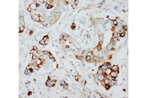 Immunohistochemistry (IHC) image for anti-S-Phase Kinase-Associated Protein 2 (SKP2) (N-Term) antibody (ABIN3032601)