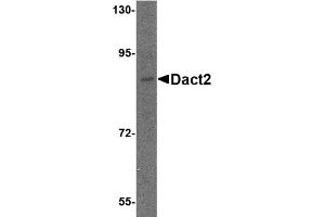 Western Blotting (WB) image for anti-Dapper, Antagonist of beta-Catenin 2 (DACT2) (N-Term) antibody (ABIN1031341) (DACT2 抗体  (N-Term))