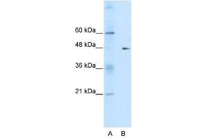 Western Blot showing GDI2 antibody used at a concentration of 1-2 ug/ml to detect its target protein. (GDI2 抗体  (C-Term))