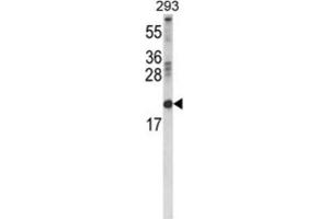 Western Blotting (WB) image for anti-Retinol Binding Protein 2, Cellular (RBP2) antibody (ABIN3004227) (RBP2 抗体)