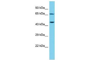 Host: Rabbit Target Name: CTTNBP2NL Sample Type: NCI-H226 Whole Cell lysates Antibody Dilution: 1. (CTTNBP2NL 抗体  (N-Term))